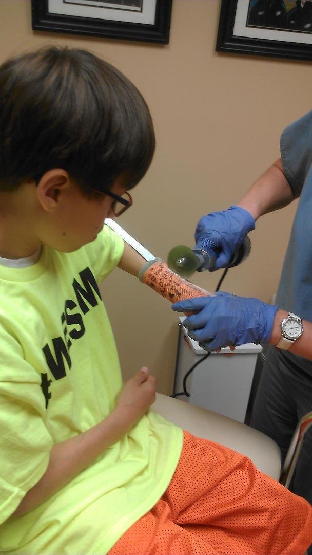 Off with a cast