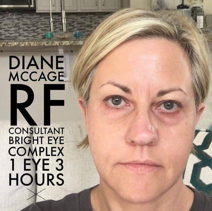 Have I mentioned how excited I am about our NEW Bright Eye Complex!? I mean, seriously!? The before and afters are incredible! 

Be the first to get it here! Go BRIGHT ahead!