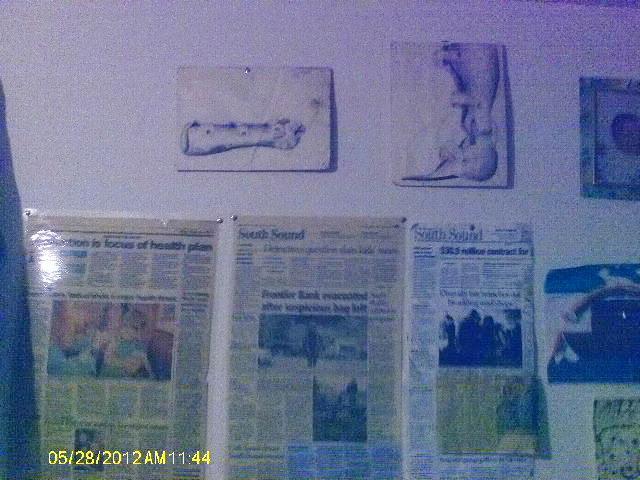 Drawings I did of one of my leg braces and favorite hand brace.