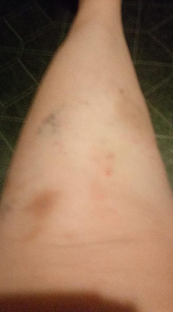 Other leg.