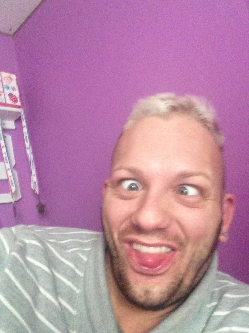 Ever wonder why I have no hair and my beard is grey? This is why