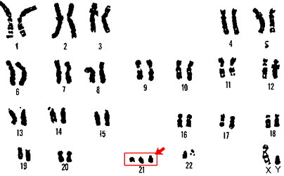 Chromosomes
