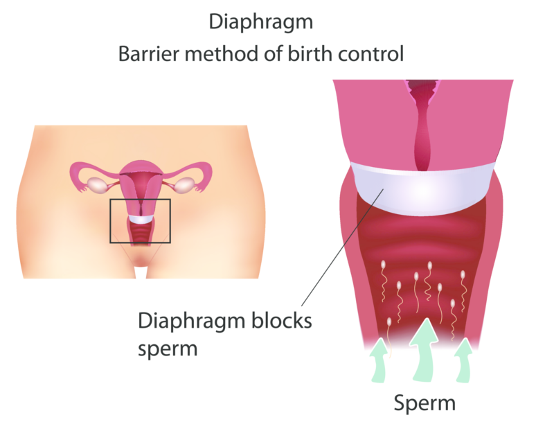 Diagram of how a diaphragm works and functions