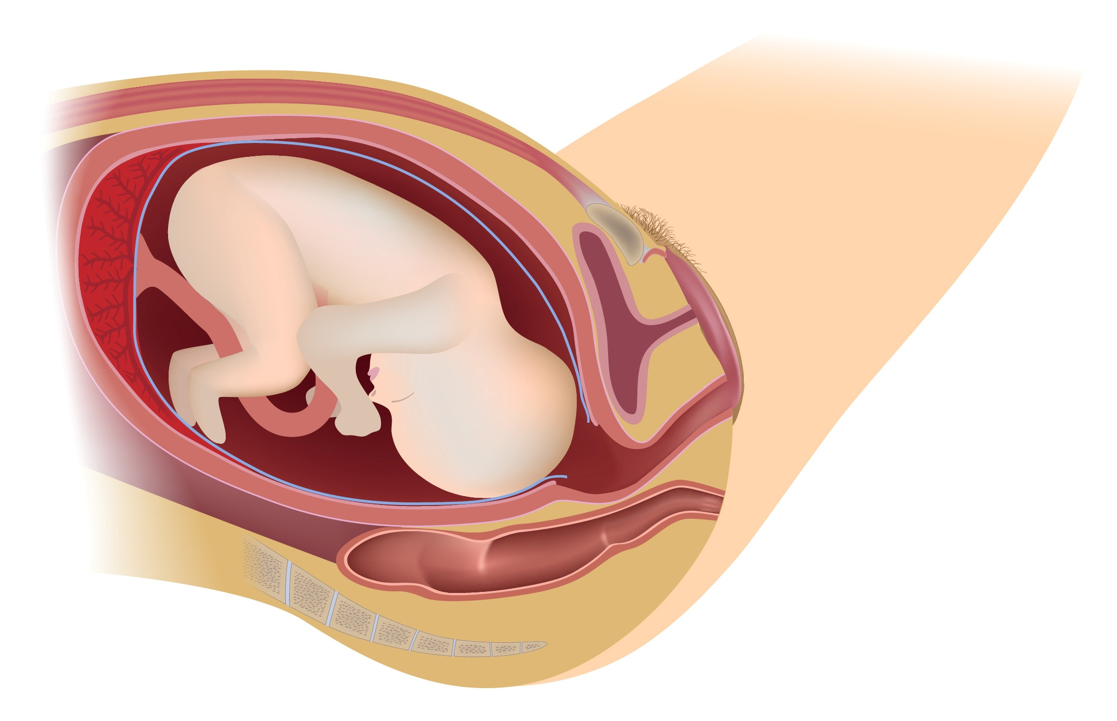 End of stage one labor picture