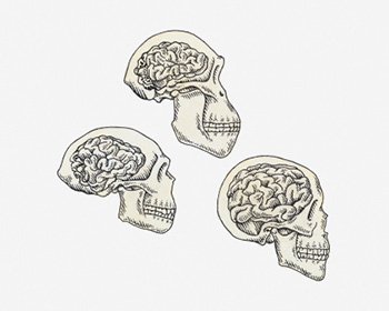 Large, Complex Brains