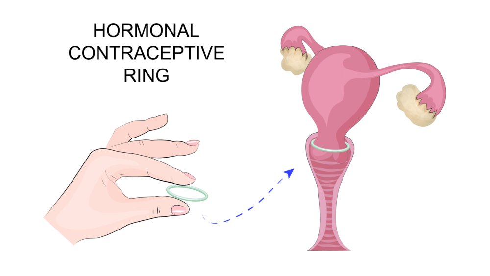 Diagram of how the ring works