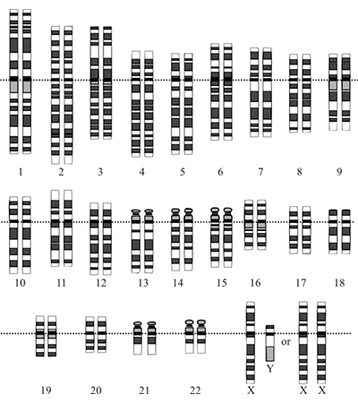 Karyotype Diagram