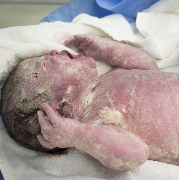 Newborn baby picture