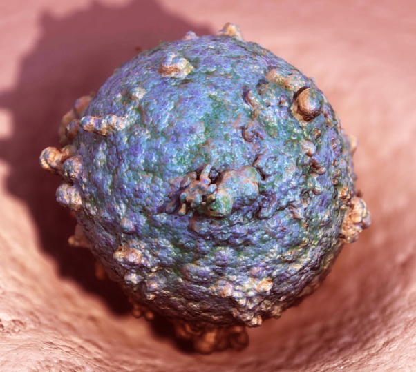 Clumped bacteria that cause gonorrhea