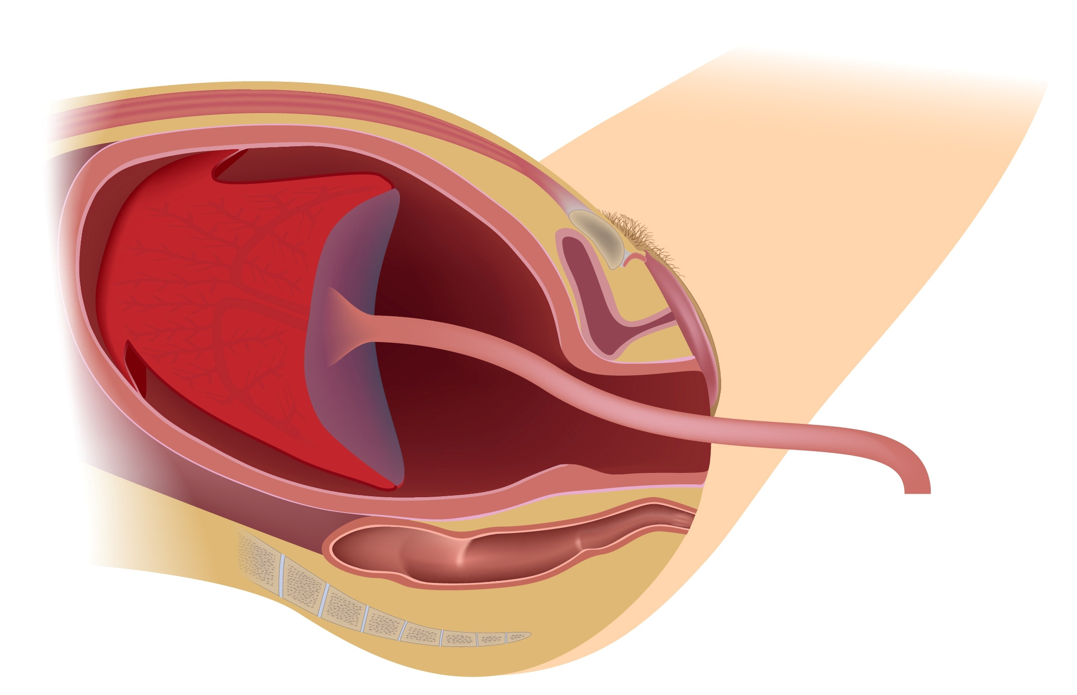 Stage three of of labor