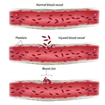 Injured blood vessels stop bleeding through a positive feedback mechanism