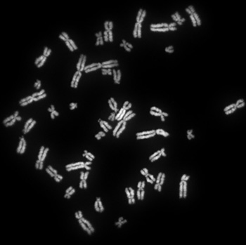 Chromosomes