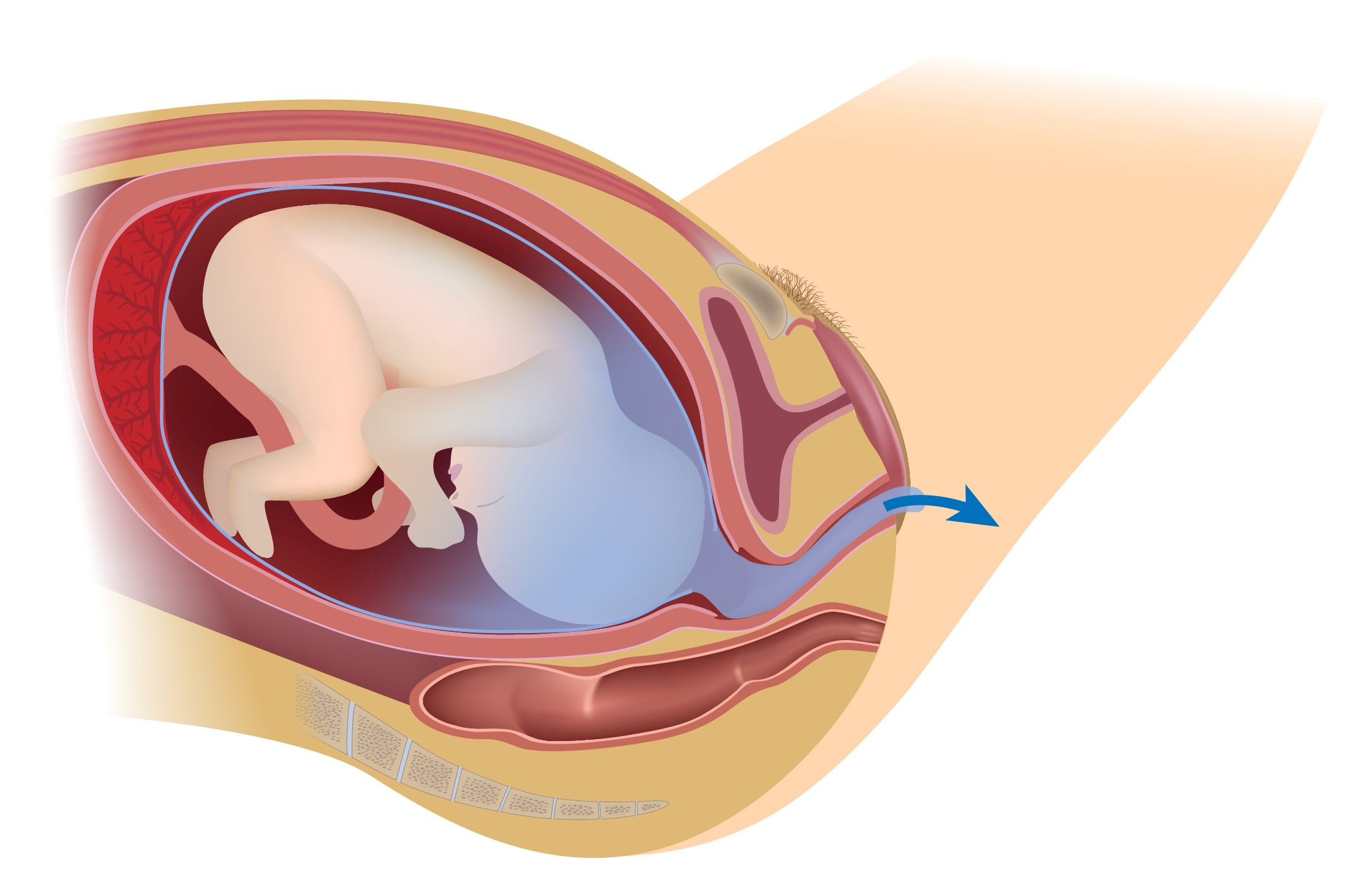 Stage one of of labor picture