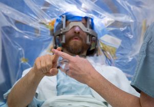 Deep brain stimulation - dexterity