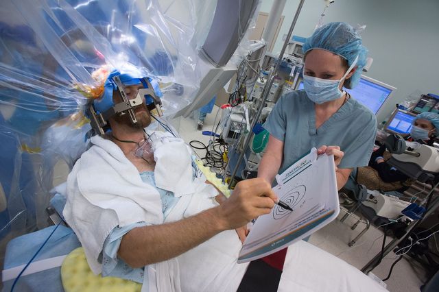 Deep brain stimulation - drawing