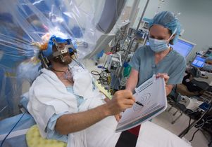 Deep brain stimulation - drawing