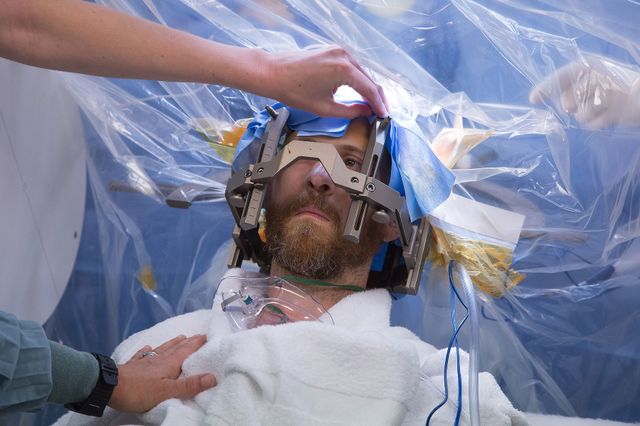 Deep brain stimulation