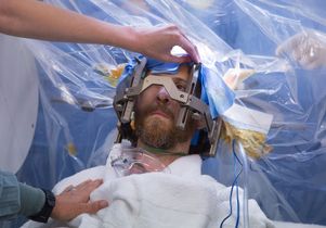 Deep brain stimulation