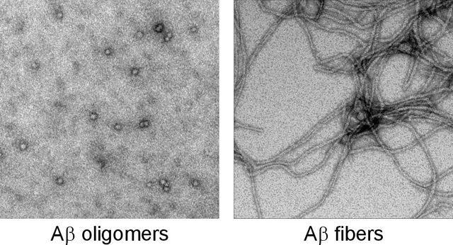 Molecular structures of Aβ oligomers and Aβ fibers