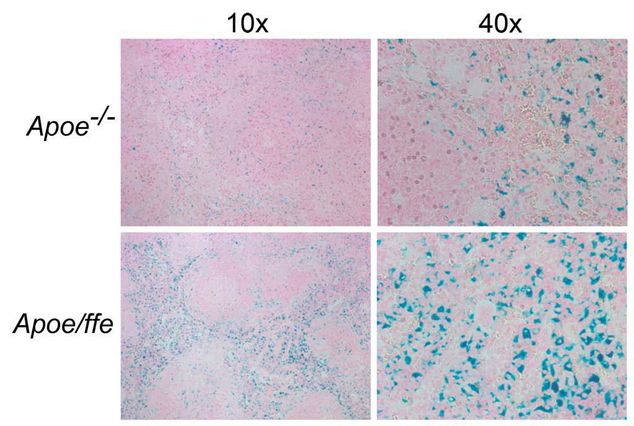 Iron-loaded macrophages