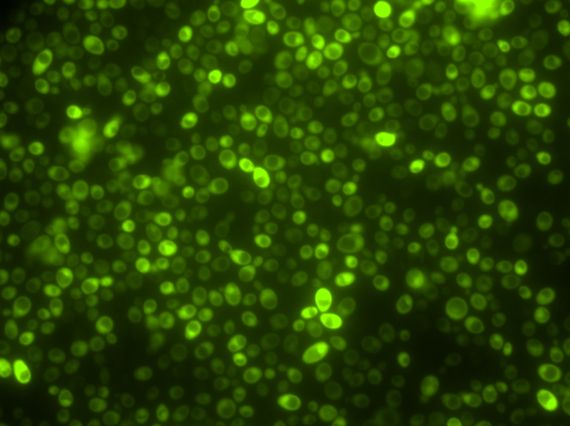 Yeast cells expressing proteins