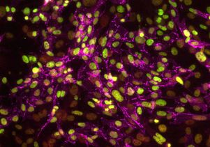 Induced pluripotent stem cells