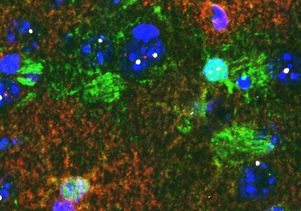 Astrocytes in brain tissue