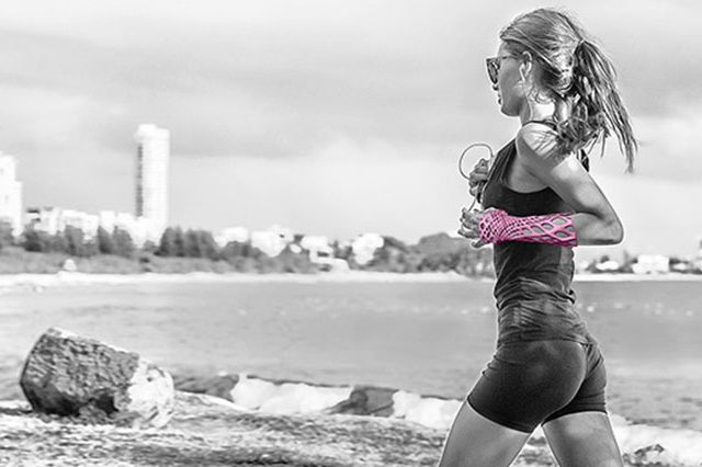 Splint created using 3-D printing