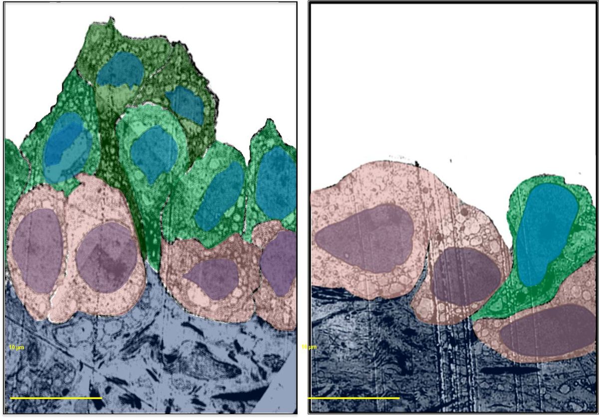 Epithelial cells