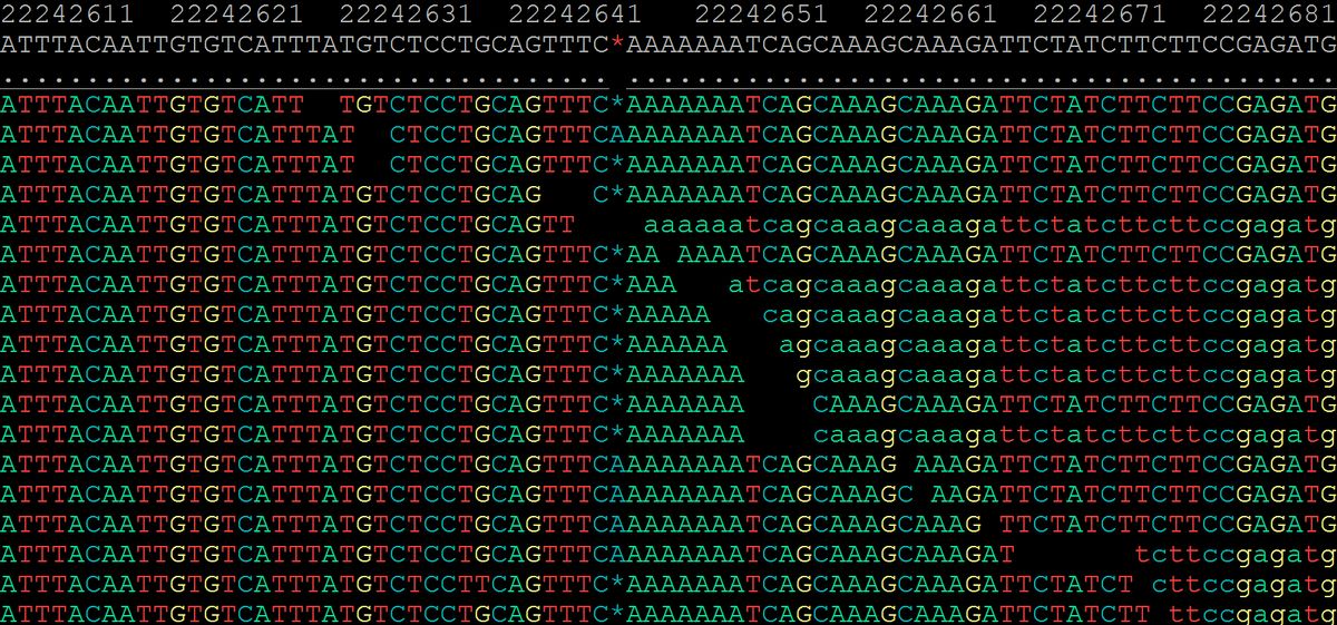 DNA sequence alignment