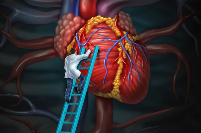 Heart and medical intervention