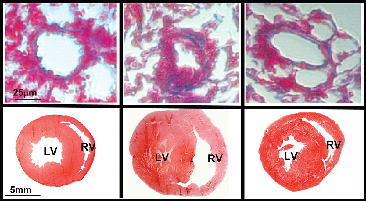 Lung and heart with microRNA-193