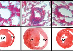 Lung and heart with microRNA-193