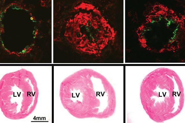 Lung and heart with 4F