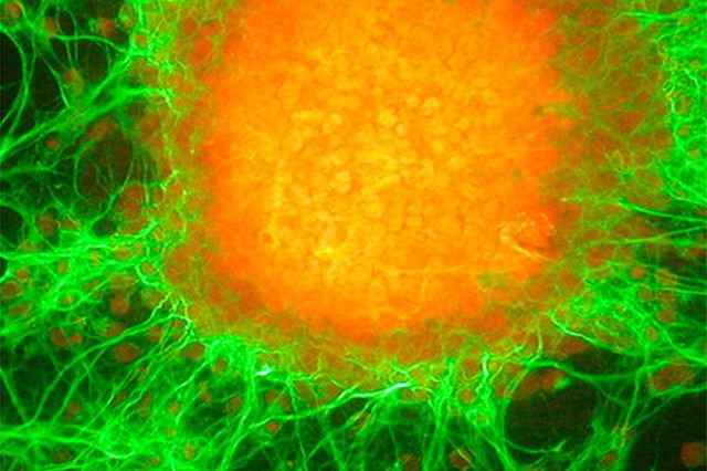 Human embryonic stem cell