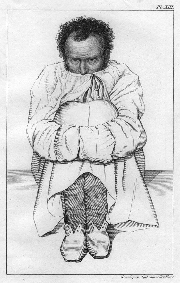 Man Who Mistook engraving