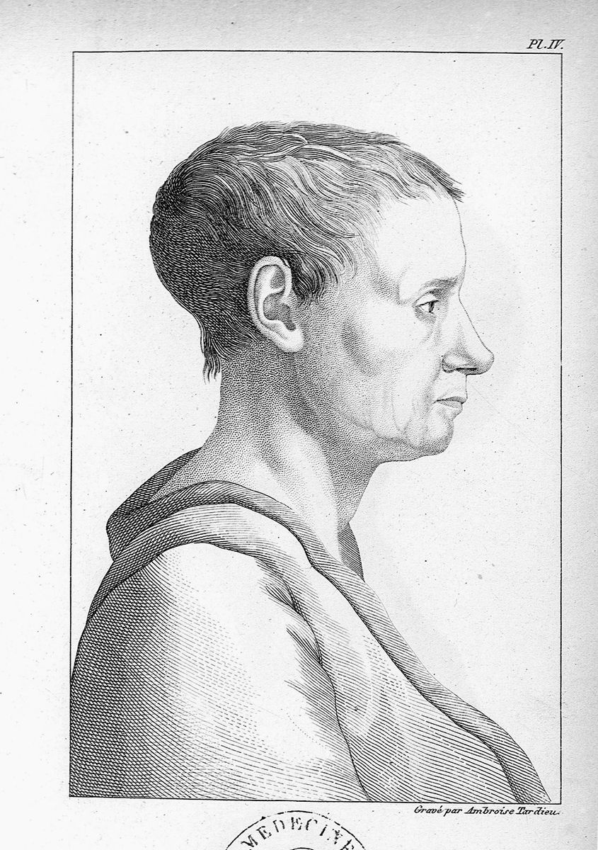 Man Who Mistook engraving 2