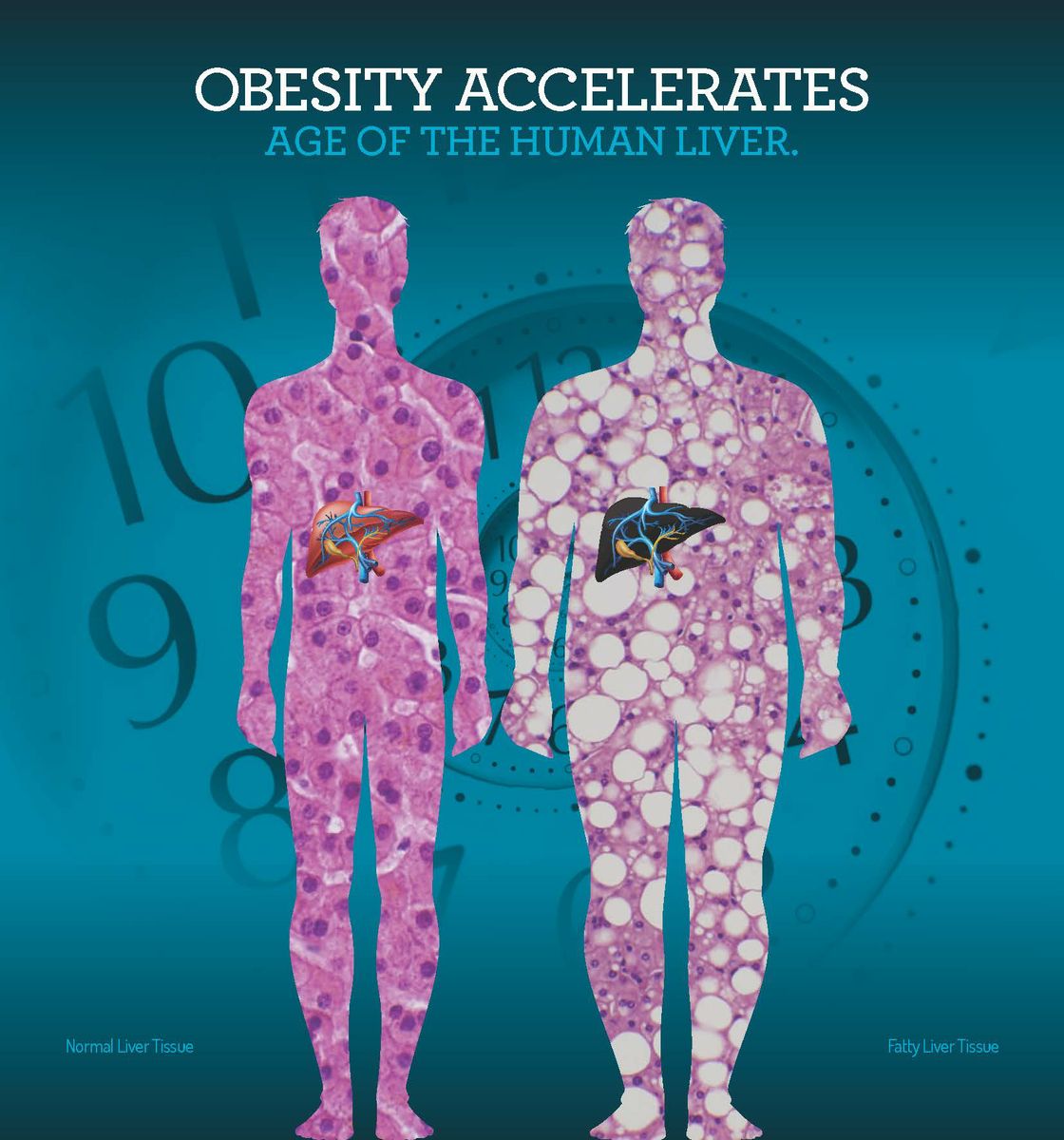 Using a novel biological clock, UCLA researchers find that obesity