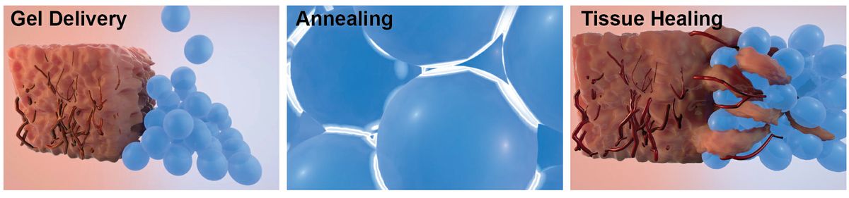 wound-healing-HSSEAS-2015