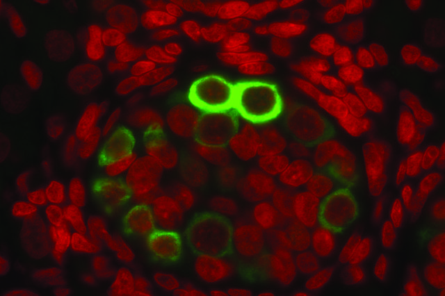male prenatal germline cells
