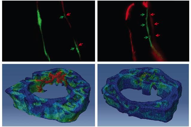 NELL1 bone treatment2
