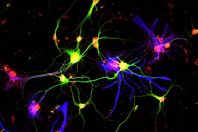 Neurons making GDF10