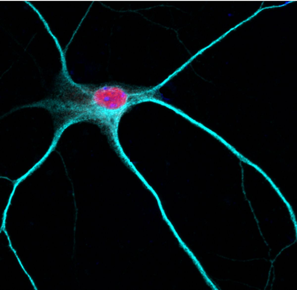Study Pinpoints Autism Linked Protein >> Untapped Region In Brain Cell Offers Goldmine Of Drug Targets For Study Pinpoints Autism Linked Protein >> Untapped Region In Brain Cell Offers Goldmine Of Drug Targets For