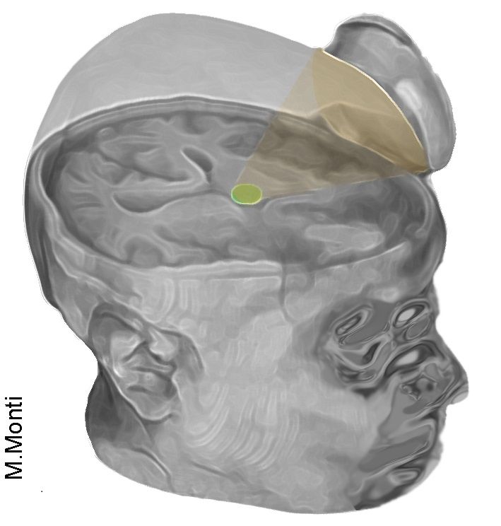 Brain image
