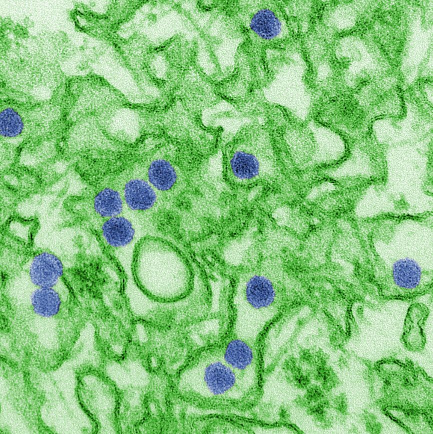 Zika virus