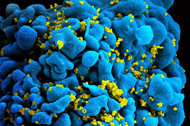 HIV infected T-cell