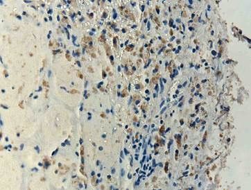 human tissue toca 511