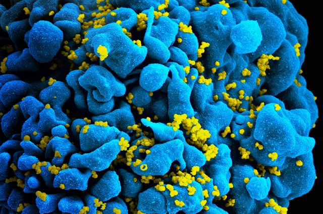 HIV infected T cell