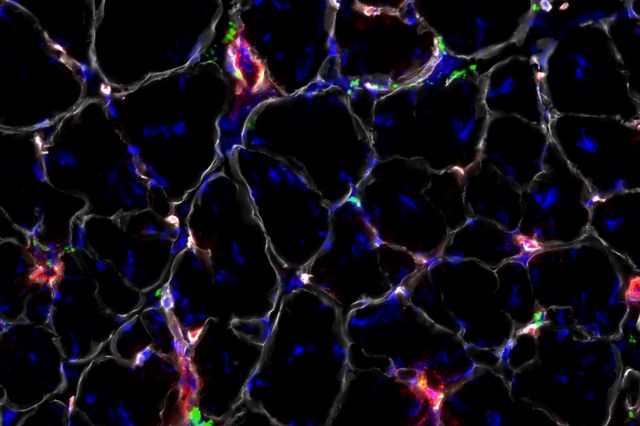 Injected nanoparticles
