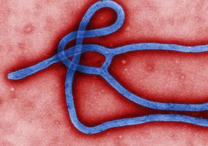 Ebola virus virion